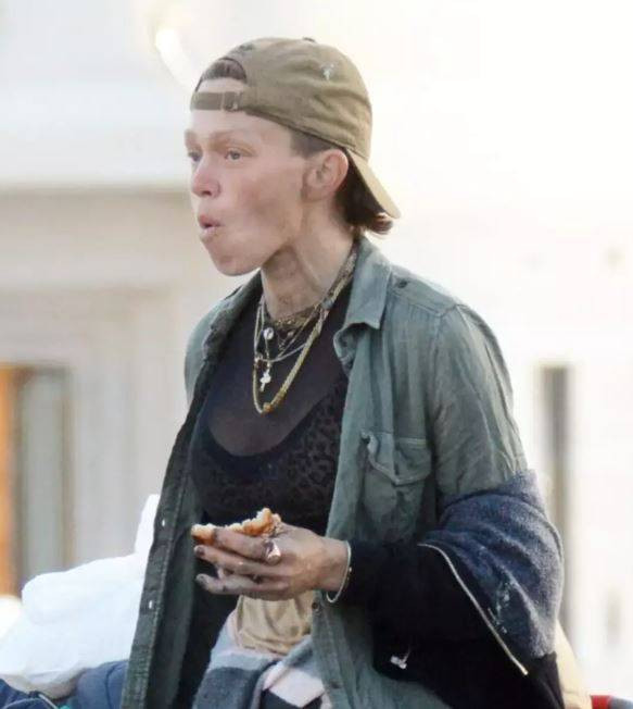 Ünlü model Loni Willison ön dişleri dökük yine çöp toplarken görüntülendi - Resim: 5